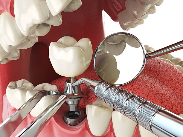 Professional Emergency Dental Service in CT